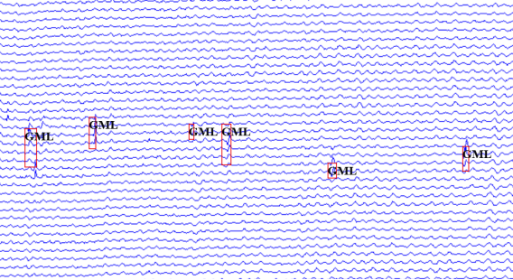 漏磁內(nèi)檢測